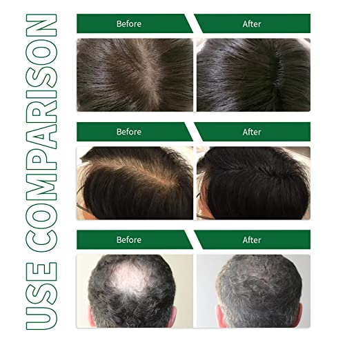 שיער לצמיחה מחודשת טיפול מורחב זרבובית מרסס לצמוח מחדש עבה למראה שיער, עוזר להחיות שיער זקיקי שיער לצמיחה מחודשת טיפול סרום עבור חזק יותר עבה יותר שיער