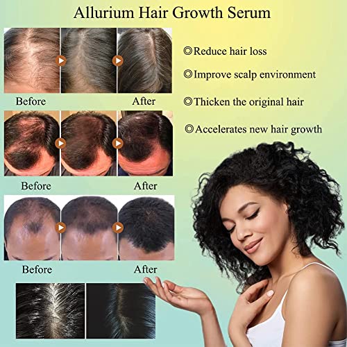 אלוריום שיער צמיחת סרום לנשים שחורות, 2023 חדש אלוריום שיער צמיחת סרום, אנטי שיער אובדן להזין יבש פגום שיער תיקון, מהיר טבעי צמיחת שיער